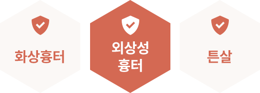 화상흉터, 회상성 흉터, 튼살