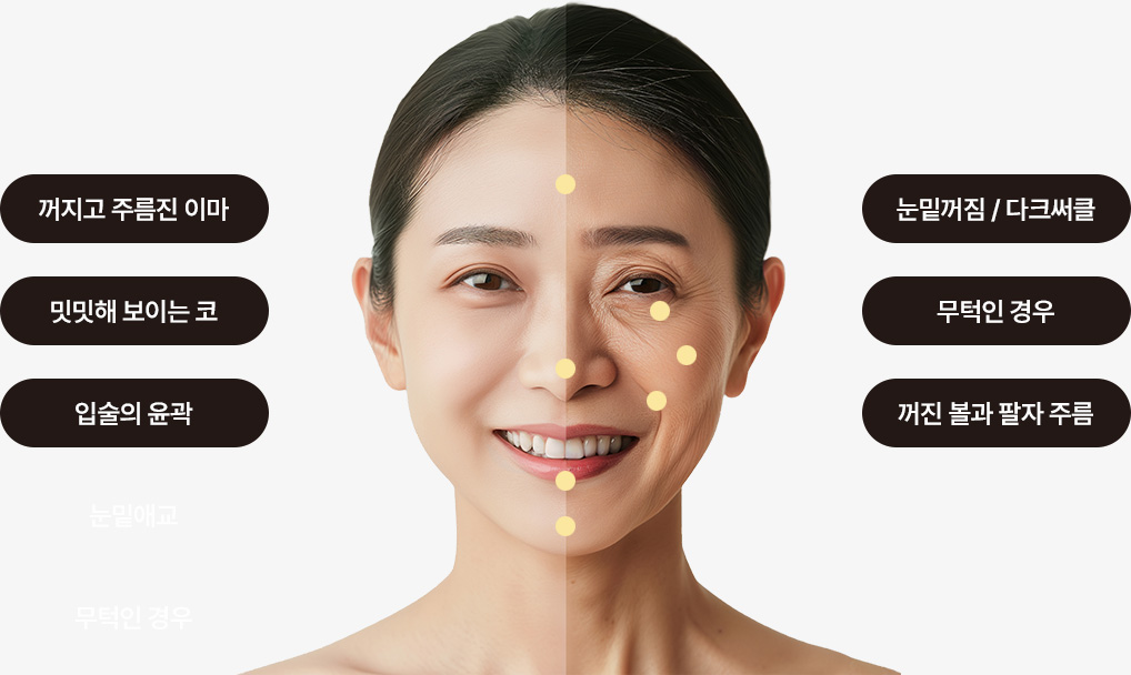 꺼지고 주름진 이마, 밋밋해 보이는 코, 입술의 윤곽, 눈밑꺼짐/다크써클, 무턱인 경우, 꺼진 볼과 팔자 주름